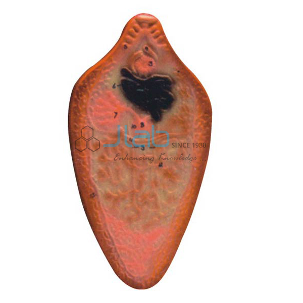Liver Fluke Model