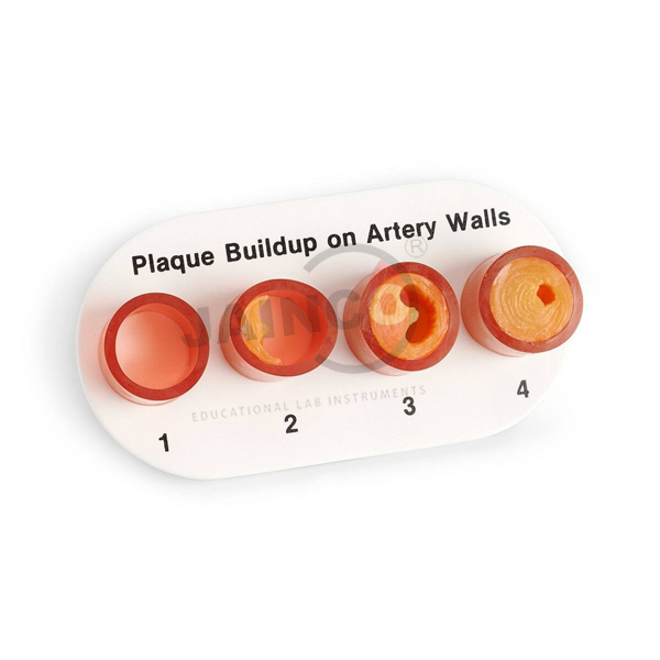 Plaque Building Anatomical Models