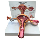 Uterus Model