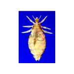 P Corporis with Egg Model