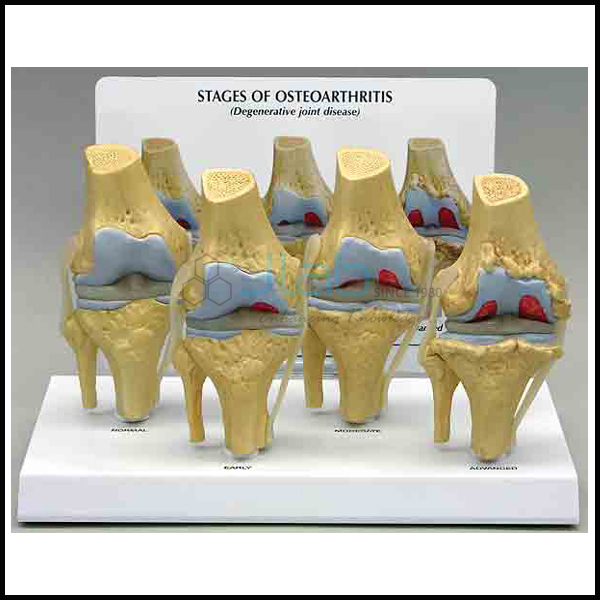 Knee Arthritis Model