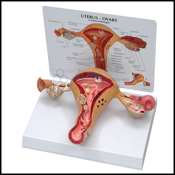 Ovaries Model