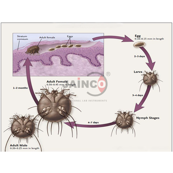 Life Cycle of Scabies Model