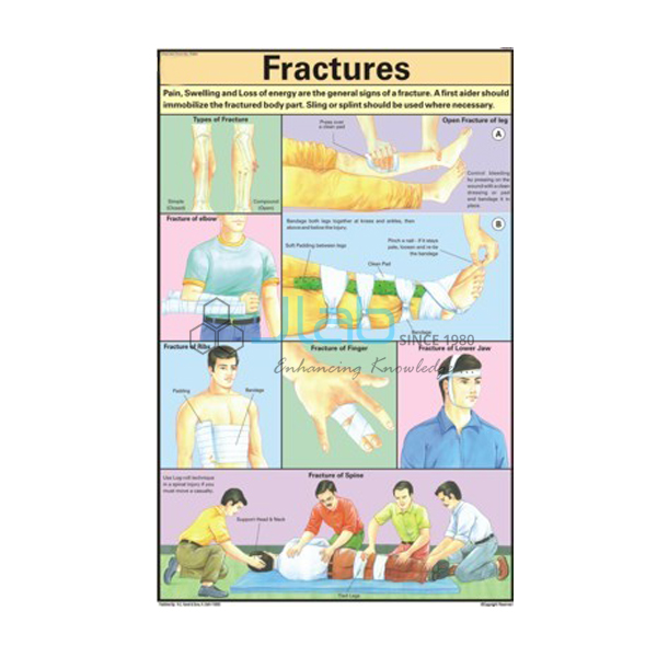 Electric Shock Treatment Chart