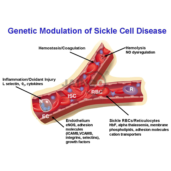 Genetic Modulation of Sickle Cell Disease Model