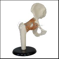 Hip Implants Model