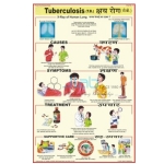 Tuberculosis Chart