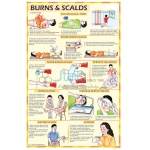 Burns and Scalds Chart