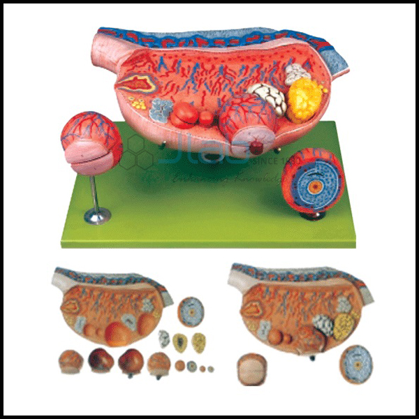 Ovary Model