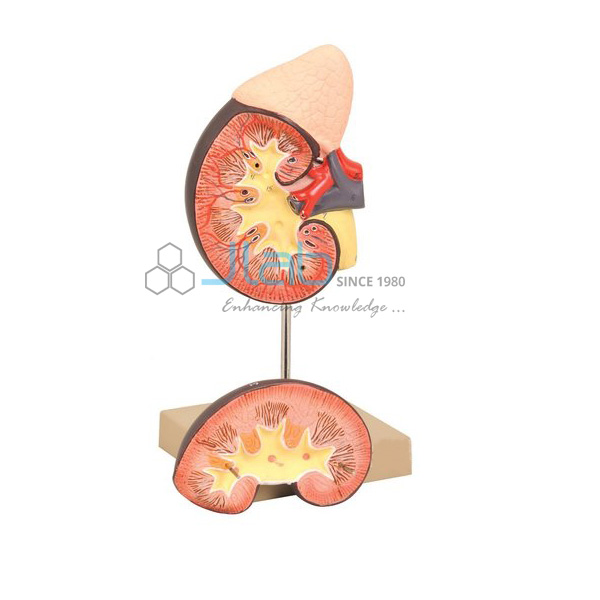 Human Kidney with Adrenal Gland