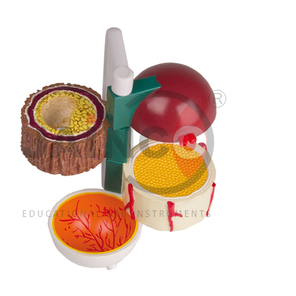 Diabetes Model Set of 4 Piece