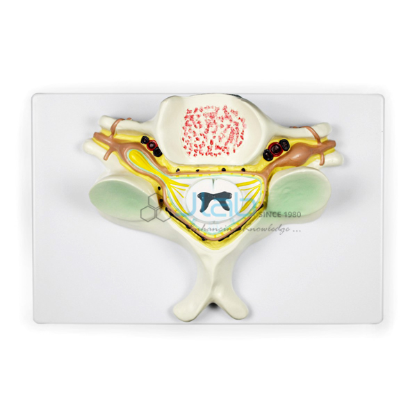 Fifth Cervical Vertebrae