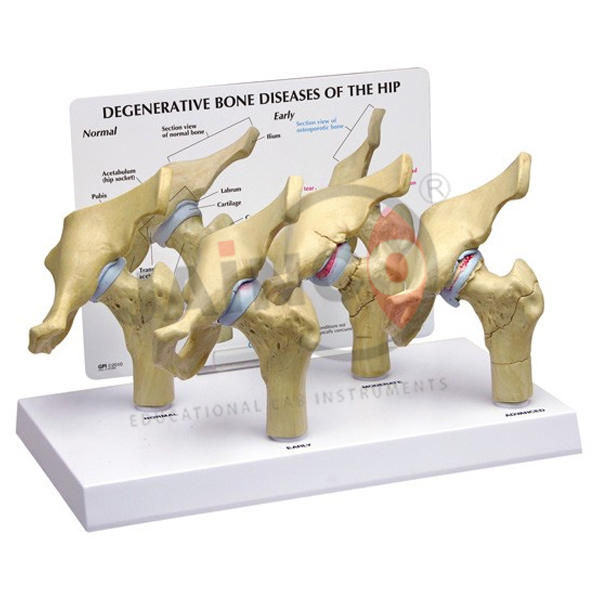 Hip Osteoarthritis Model