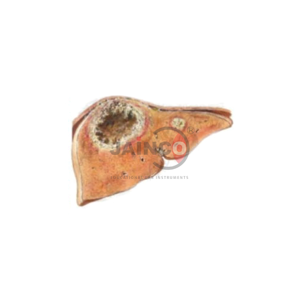 Amoebic Liver Abscess Model