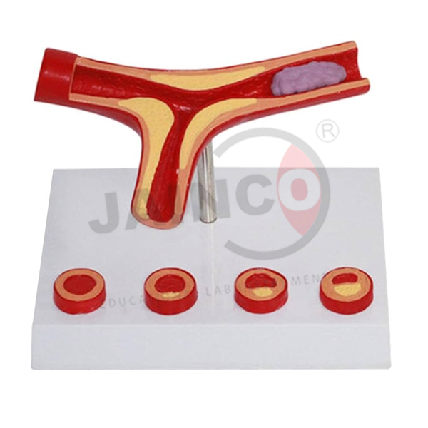 Arteries Models
