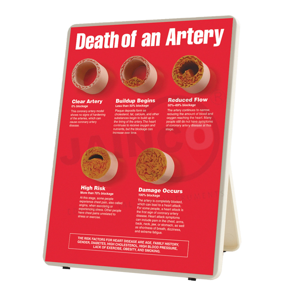 Death of an Artery Models