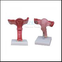 Magnified Uterus Model