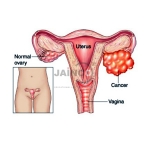 Neisseria Species Model