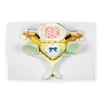 Fifth Cervical Vertebrae