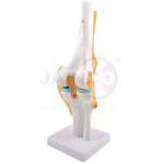 Knee Implant Model
