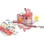 Enterobacteriaceae Model