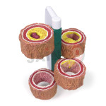 Artery Model Showing Plaque Building