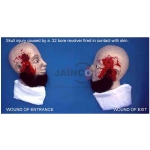 Skull Injury Model