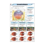 Eye and its Defects