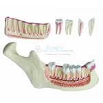 Lower Jaw Model
