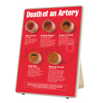 Death of an Artery Models