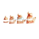 Dentition Development