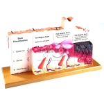 Degree of Burn Model