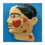 Nodulation Lepra Reaction Model